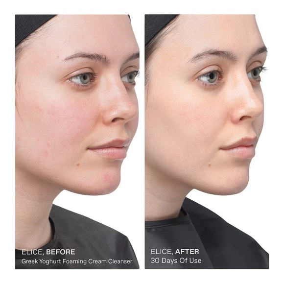 Korres Greek Yoghurt Foaming Cream Cleanser Pre + Probiotics - Picture 7 of 10